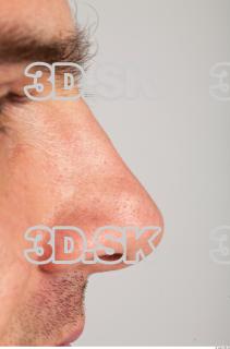 Nose texture of Gene 0002